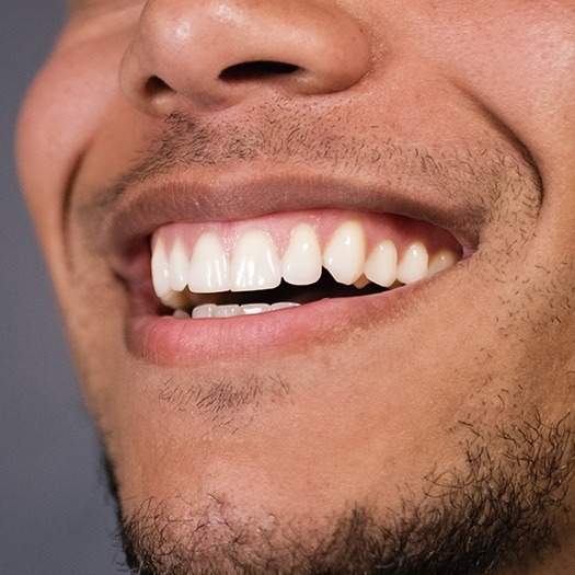 Man sharing smile after tooth-colored filling restoration