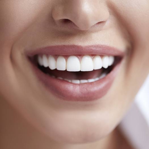 Closeup of smile after gum recontouring