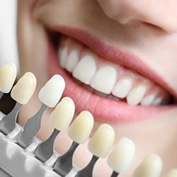 Dental shade guide next to women’s teeth