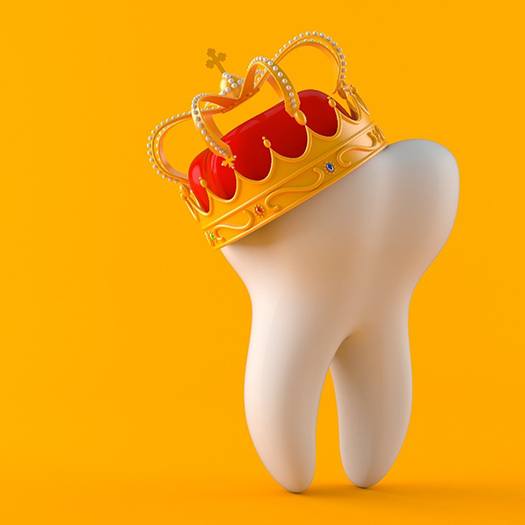 Illustration of tooth wearing crown