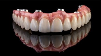 A large model tooth sitting next to a piggy bank and coins