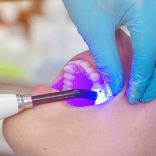 Woman undergoing cosmetic bonding