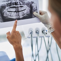 Implant dentist in Summerfield explaining treatment to a patient