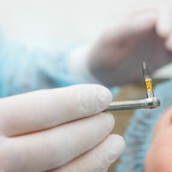 dentist holding implant during surgery  