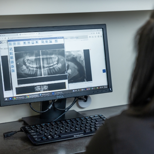 Dental team members reviewing digital x-rays