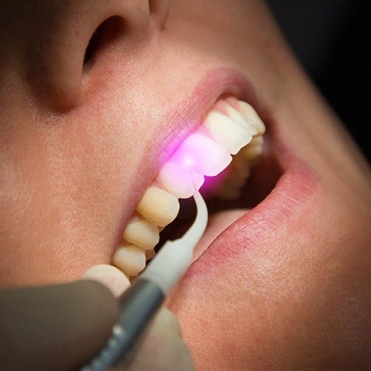 Patient receiving soft tissue laser dentistry