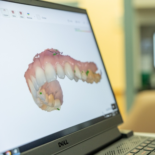 Dentist showing patient digital smile design on computer