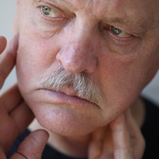 Man with jaw pain due to TMJ disorder in Summerfield, NC 