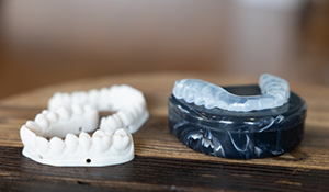 Clear tray over a model of the teeth