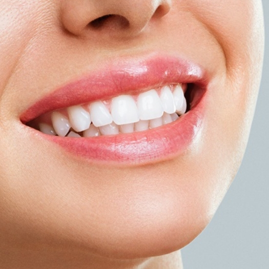 A close-up of a patient who received teeth whitening in Summerfield