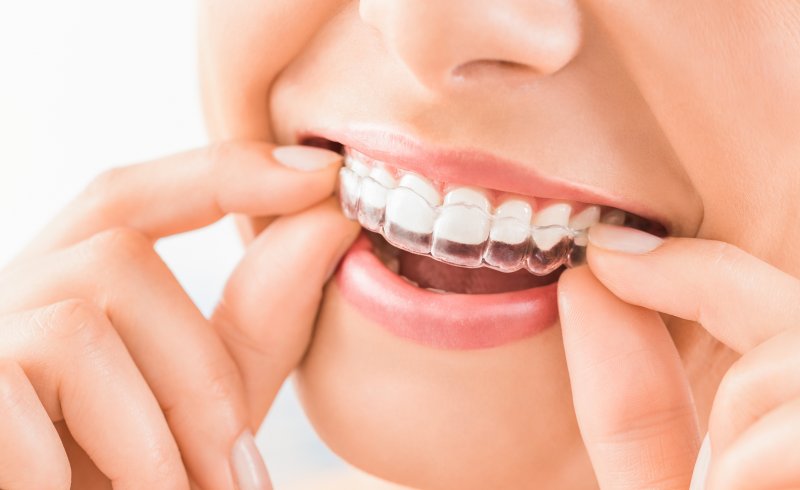 Closeup of a young woman taking off her aligner