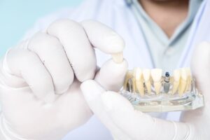 White-gloved hands holding sample dental crown and model implant in clear jaw base